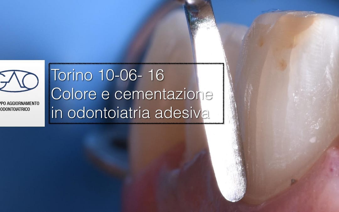 2016 Torino GAO strategie per le faccette dentali