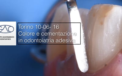 2016 Torino GAO strategie per le faccette dentali
